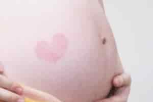【妊娠線予防】保湿が大事！今すぐできる3つの対策とおすすめの保湿剤